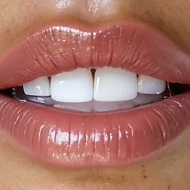 Close-up detail, Isela Viera