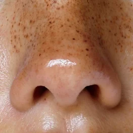 Close-up detail, Isela Viera